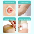 thumbnail image 2 of 30ML Colostomy Adhesive Wipe-off Spray Medical Adhesive Remover Care Produc, 2 of 6