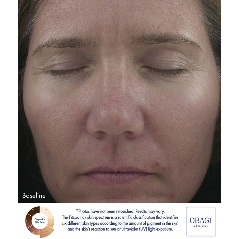grundlæggende Specialisere mandskab Obagi360 Retinol Moisturizing Facial Cream 1.0, 1 oz - Walmart.com