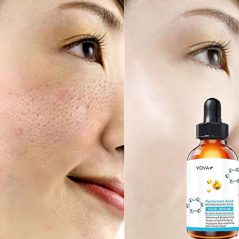 Buy Hyaluronic Acid Shrink Pores Serum Exfoliating Moisturizing Nourish
