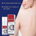 thumbnail image 3 of Vitiligo Treatment Spray, White Spots Remover Skin Renewal Herbal Spray, Improve Pigmentation Anti-Melanin Spray, 3 of 5