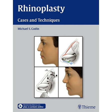 UPC: 9781604066807 | Rhinoplasty: Cases and Techniques (Hardcover)