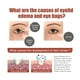 thumbnail image 2 of Crema para ojos con suero para ojos, hidratante, antiarrugas, reafirmante, antibolsas y antiedad. Crema para ojos con péptidos., 2 of 5