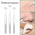 thumbnail image 3 of EXLEAF Blackhead Extraction Tool Kit - Blackhead Remover Tool Comedones Extractor Acne Removal Kit for Blemish Pimple Popper Tool for Whitehead Popping - 7 Pcs Set Removing for Nose Face Tools, 3 of 8