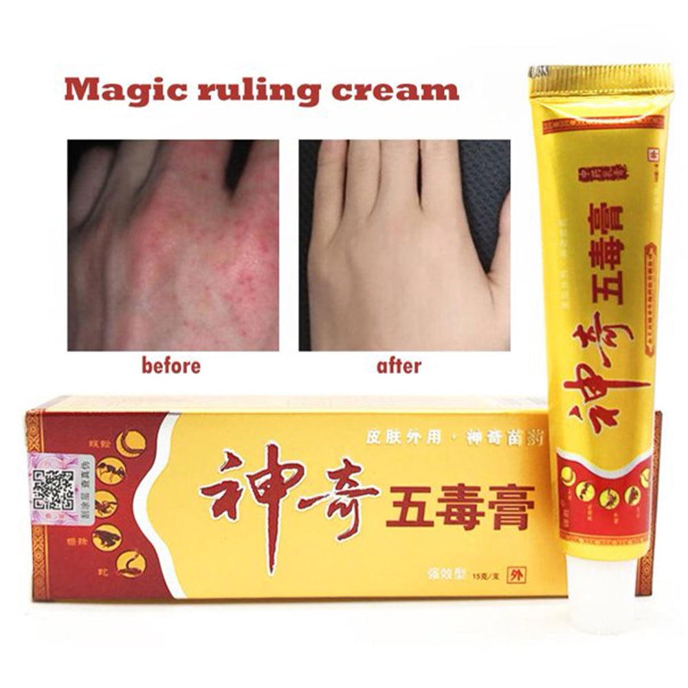 15g/box Herbal Psoriasis Ointment Cream Dermatitis Eczema Pruritus