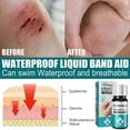 thumbnail image 2 of Medical Glue For Cuts, Fast-drying & Breathable Liquid Skin Bandage, Great For Use On Fingers, 2 of 5