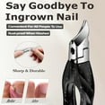 thumbnail image 2 of Ingrown Toenail Clippers - Start Makers Nail Clippers for Men & Seniors Toenail Clippers with Cover and Long Non-Slip Handle, 2 of 6