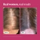 thumbnail image 4 of Suplementos para el crecimiento del cabello para mujeres, producto clínicamente probado, con complejo de colágeno, cabello más grueso y con más volumen, 180 tabletas, dura 3 meses, 4 of 5