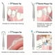 thumbnail image 3 of Dental Water Flosser Spotlight Waterpik Professional Oral Irrigator Portable Water Flosser Healthy Teeth Whitening Cleaner White, 3 of 4