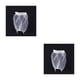 thumbnail image 1 of Colador Triangular Toystoory para fregadero de cocina ABS resistente Tipo 2 2Conjunto, 1 of 6