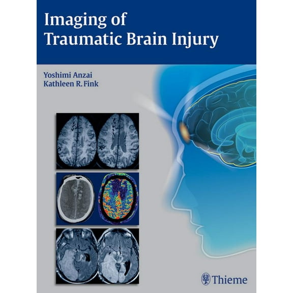 Imaging of Traumatic Brain Injury (Hardcover)