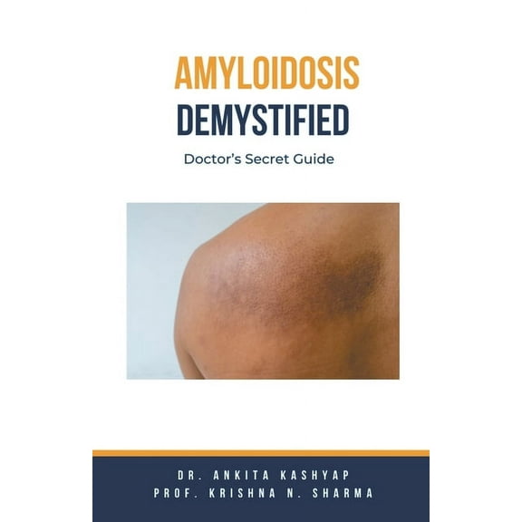 Amyloidosis Demystified: Doctor's Secret Guide, (Paperback)