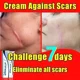 thumbnail image 2 of Cicatrices quirúrgicas de reparación efectiva, eliminación de cicatrices antiguas, estrías, acné, fosas, marcas de acné, quemadura, Scars090, 2 of 5