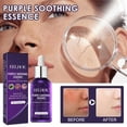 thumbnail image 1 of Hot6sl Ofertas de La Semana Calmante Morado, Calmante Multi Morado 30 Ml, 1 of 7
