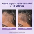 thumbnail image 3 of Bare Anatomy Nature x Science Rosemary Hibiscus Hair Growth Oil for Women & Men | Helps Hair Growth & Strengthens Hair | Nourishes Scalp & Controls Hair Fall | Suitable for All Hair Types-100ml, 3 of 5