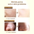 thumbnail image 1 of NITRIP Los poros a granel que se encogen Reparar Suavizar el suero de la cara Control del aceite Tratamiento 10 ml ANGGREK  Otros, 1 of 8