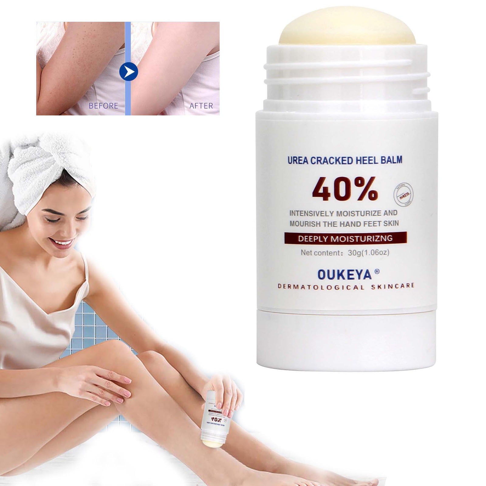 YiFudd Urea Foot Cream,Urea Cream For Feet, Urea Foot Cream 40 Percent