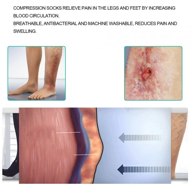 Medias De Compresión Elástica De La Pierna Medias De Venas Varicosas