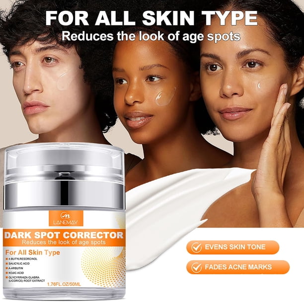 Xihbxyly Crema Hidratante Corporal, Loción Hidratante con Ingredientes Naturales, Fórmula Suavizante Intensiva para La Piel, Crema para Zonas Sensibles, Hidratación Diaria, Blanqueamiento y Revitaliz