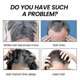 thumbnail image 2 of Ouhoe Bamboo Charcoal Shampoo Soap Deep Cleansing Scalp Strengthening Hair, 2 of 5