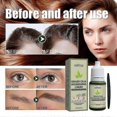 thumbnail image 3 of Revitalize Your Hair With EELHOE Nourishing Grass Ciliary Liquid Grass Ciliary, 3 of 5