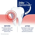 thumbnail image 5 of Sensodyne Full Protection Whitening Sensitive Toothpaste, 4 oz, for Adults, 5 of 11