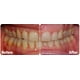 thumbnail image 2 of Probióticos orales ProbiOra Professional Strength, cuidado de dientes y encías, 2 of 5
