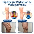 thumbnail image 2 of QARUN Microdarts Patch,Vein Target Patch,Relieve Leg Discomfort,Soothes Leg Discomfort,Effectively Moisturizes (1Pc), 2 of 7