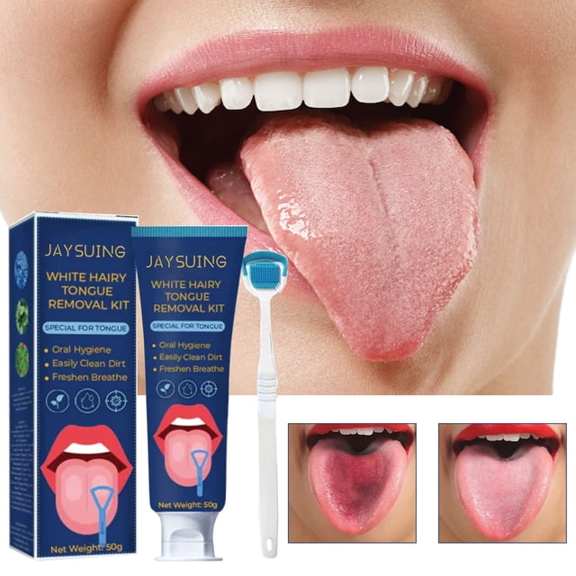 Gel limpiador de lengua, kit de cepillo limpiador de lengua, desodorante bucal, eliminador de olores, pasta de dientes