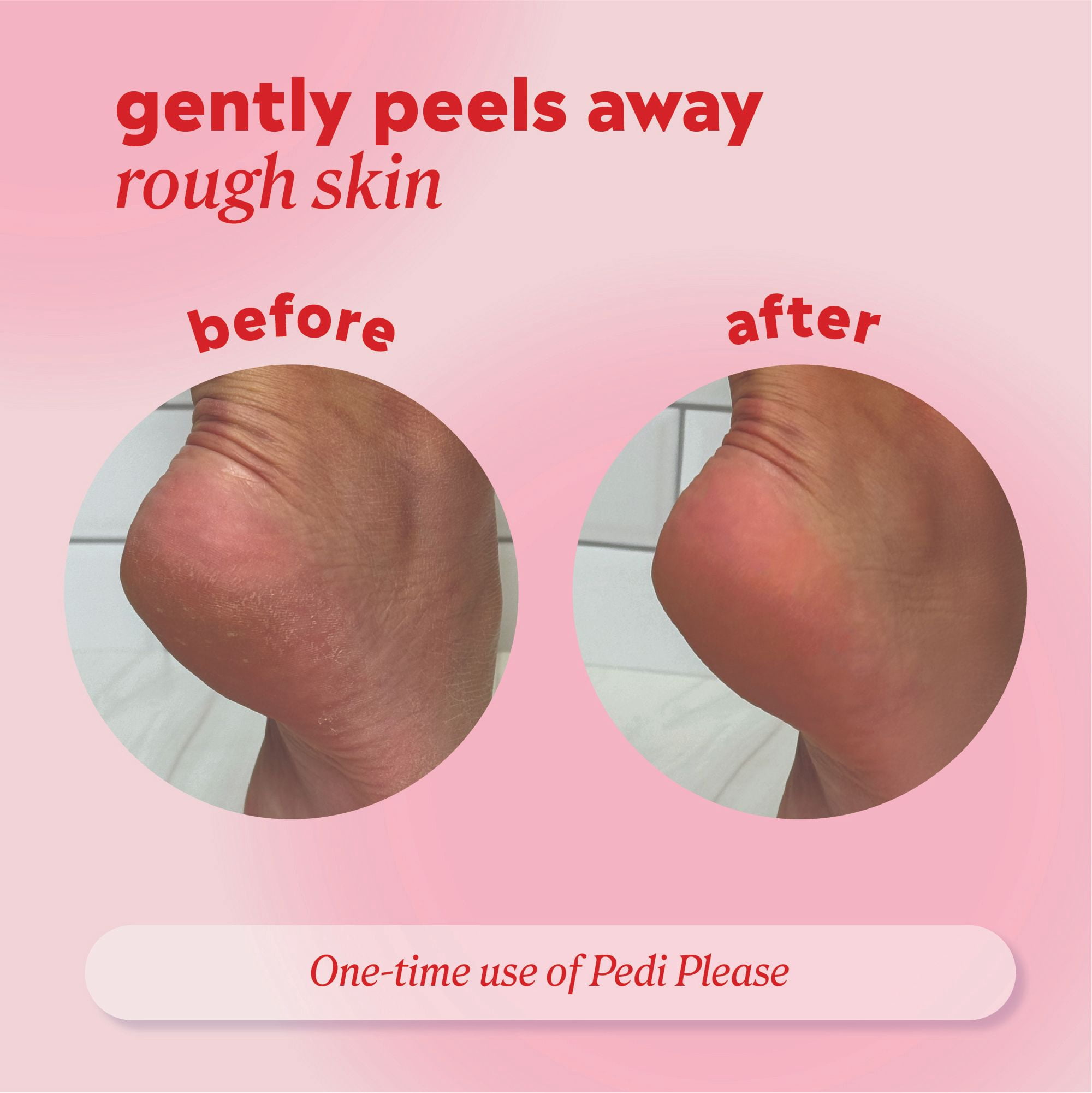 ONYX Professional Pedi Please Quick Peeling Foot Mask