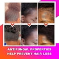 thumbnail image 4 of 3x African Chebe Oil Hair Strengthener Chebe Extreme Hair Growth Spray Fast Edges Growth Alopecia Hair Oil Hair Loss Treatment, 4 of 5