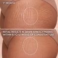thumbnail image 5 of Cicatrissim White Stretch Mark Cream, Intensive Body Moisturizer for Uneven Skin Texture, All Skin Types, 5.3 oz, 5 of 8
