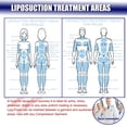 thumbnail image 2 of KUSMOO 3 Pack Lipo Foam Board Ab Board Post Surgery Liposuction Abdominal Flattening Compression Board BBL Lumbar Molder Backboard For Liposuction, 2 of 5