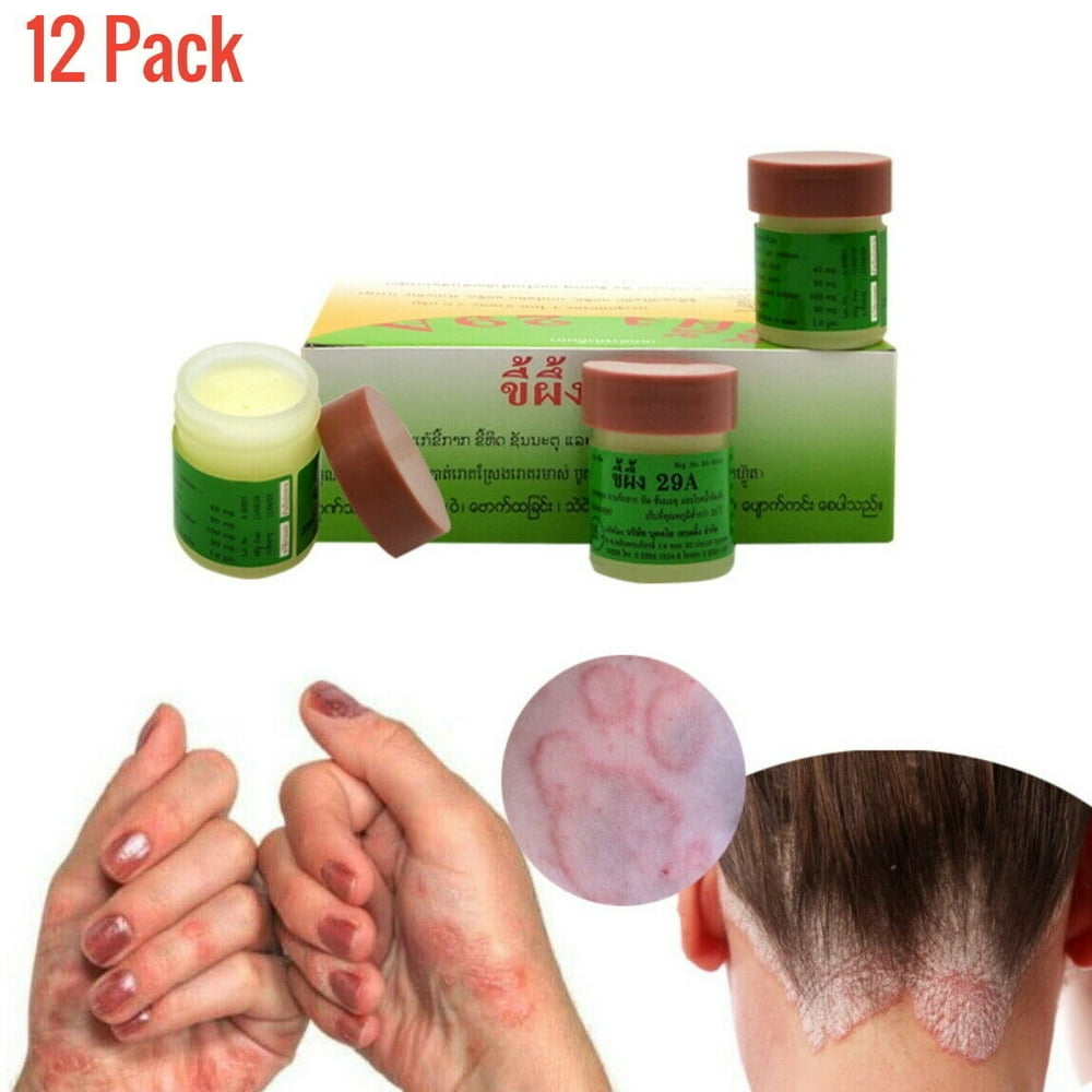 Natural Aid For Scabies, Psoriasis, Jock Itch, Ringworm, Herpes