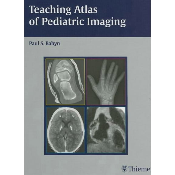 Teaching Atlas of Pediatric Imaging (Hardcover)