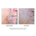 thumbnail image 5 of Scar Gel, 5 of 5