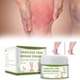 thumbnail image 1 of Crema para venas varicosas para promover la circulación sanguínea y tensar la piel, suministros para el cuidado de las piernas, crema para venas varicosas de araña, 1 of 8