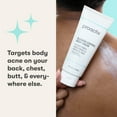 thumbnail image 7 of Proactiv Blemish Control Body Cream with 1.5% Salicylic Acid, Acne Treatment for Body, 4 Fl Oz, 7 of 7