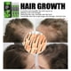 thumbnail image 1 of Herramienta para el cabello denso con esencia natural espesante para la prevención de la caída del cabello (3 piezas) Ndcxsfigh  Cuidado Belleza, 1 of 6