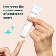 thumbnail image 2 of Proactiv Post Acne Scar Treatment Gel, Resurfaces Skin & Smooths Rough Texture, 1 Fl Oz, 2 of 8