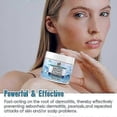thumbnail image 4 of Seborrheic Dermatitis Cream, Anti Fungal Shampoo- Nourishing Care, Scalp Treatment for Psoriasis, Folliculitis, Dry Scalp, Anti-Itch, 4 of 5