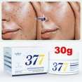 thumbnail image 3 of 377 Crema blanqueadora para pecas, aclara las manchas oscuras, mejora el tono de la piel opaca, loción iluminadora hidratante para mujeres y hombres, novedad de 2024, 3 of 5