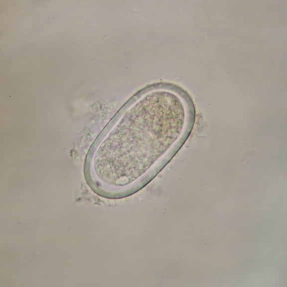Enterobius Vermicularis Eggs Slide, W.M.