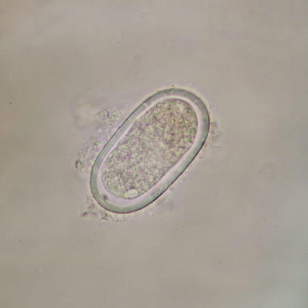 Enterobius Vermicularis Eggs Slide  W.M. price history on PriceWatchPro
