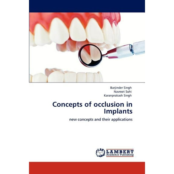Concepts of occlusion in Implants (Paperback)