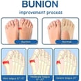 thumbnail image 2 of Orthoes Bunion Relief Socks Women, Orthoes Socks, Orthoes Bunion Corrector Socks for Women (Mix,5 Pairs), 2 of 8
