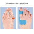 thumbnail image 3 of Cotton Elastic Toe Bunion Correction Tape Pre-Cut T Design, Superior Stretch, Breathable for Walking, Running and Sports, 3 of 8