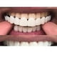 thumbnail image 5 of New Snap On Smile Dental Upper False Teeth Cover Perfect Smile Veneers Comfort Fit Flex Denture Teeth Whitening Braces, 5 of 5