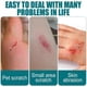 thumbnail image 5 of Body Skin Glue Medical Adhesive Liquid Band-Aid 10ml 2024, 5 of 5