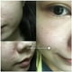 thumbnail image 3 of Solución de ácido salicílico al 2% de 30ml, elimina el suero facial para el acné, reduce la esencia hidratante de los poros, ilumina el cuidado de la piel del rostro Feliz Sencillez, 3 of 5