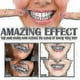 thumbnail image 4 of Jaysuing Toothbrush Tooth Cleaner Stain Remover Brightener And Whitener Mouth Cleaner To Get Rid Of Yellow Teeth And Tobacco |, 4 of 5